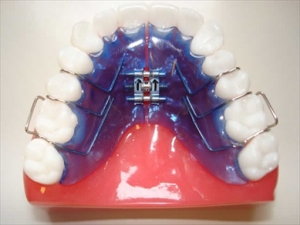 apparecchio dentale mobile