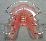 apparecchio dentale mobile meccanico