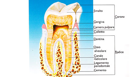 cura-canalare cos'è dott marco dormi odontoiatra
