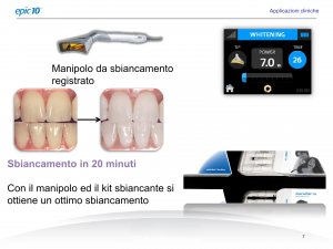 sbiancamento laser