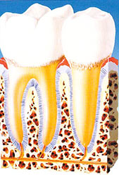 gengivite malattia parodontale