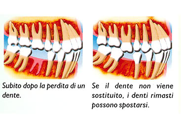 ponte dentale dott. marco dormi terni